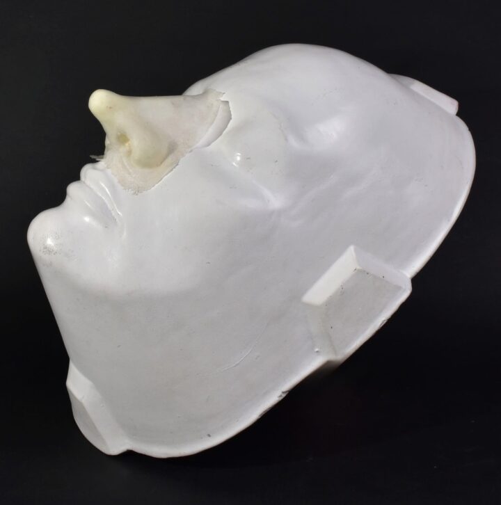 NRE Nariz Respingada